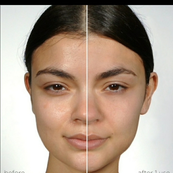 NWT Dr.Brandt Pores no more vacuum cleaner - Picture 6 of 8